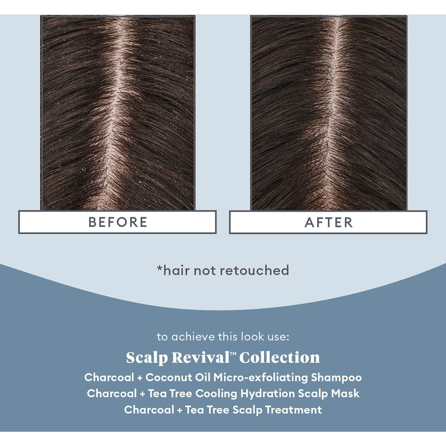 Scalp Revival™ Scalp Soothing Solutions Set