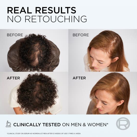 Elvital Growth Booster Hair Serum